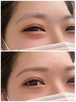 ブルー 上野御徒町(BLUE)の写真/お顔の骨格・パーツから導き出す美眉デザインで美人度UP♪濃さのバラつきや左右差、メイクのお悩みを解消!