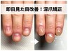 【深爪/噛み爪/むしり爪】即日見た目改善！深爪矯正初回お試し