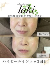 リラクゼーションサロン ラキ(laki)/ハイピールイントゥ