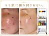 繰り返す大人ニキビ改善◎肌荒れに振り回されない毎日へ
