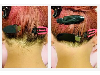 ブリリアンス(BRILLIANCE)/うなじを理想の形にデザイン♪