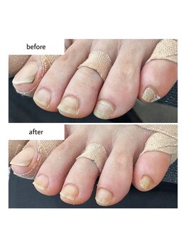 ネイルアトリエ ボン(nail atelier bon)/フットネイルケア