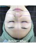 ★お子様連れOK★【光フェイシャル初回限定】乾燥/毛穴等のお悩みに ！￥3000