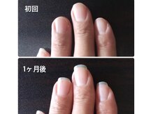 自爪ケア専門サロン イニュラ(inula)/ピンクの部分を伸ばしたい！右手