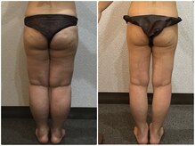 ウェリナ平和堂長久手院/小顔矯正/骨盤矯正/美脚サロン