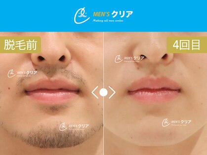 メンズクリア ゆめタウン筑紫野店の写真