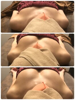 ロココ 豊田店(Rococo)/ビフォーアフター