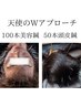 天使のWアプローチ【100本美容鍼＋50本頭皮鍼】