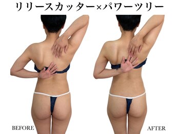 リノア(Linoa)/ボディ人気No. 1