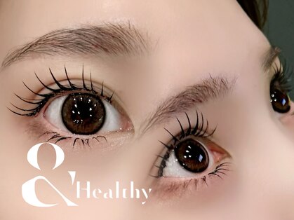 ロコ(Loco)の写真