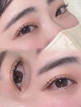 アテ(ate.)/アンドヘルシー80本