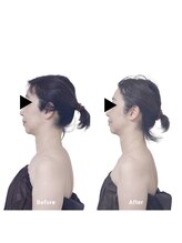 ボディケアルーム リフレキュア 中野(REFLECURE)/フェイスメソッド 小顔矯正