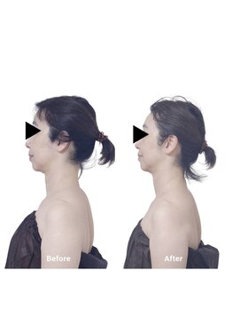 ボディケアルーム リフレキュア 中野(REFLECURE)/フェイスメソッド 小顔矯正