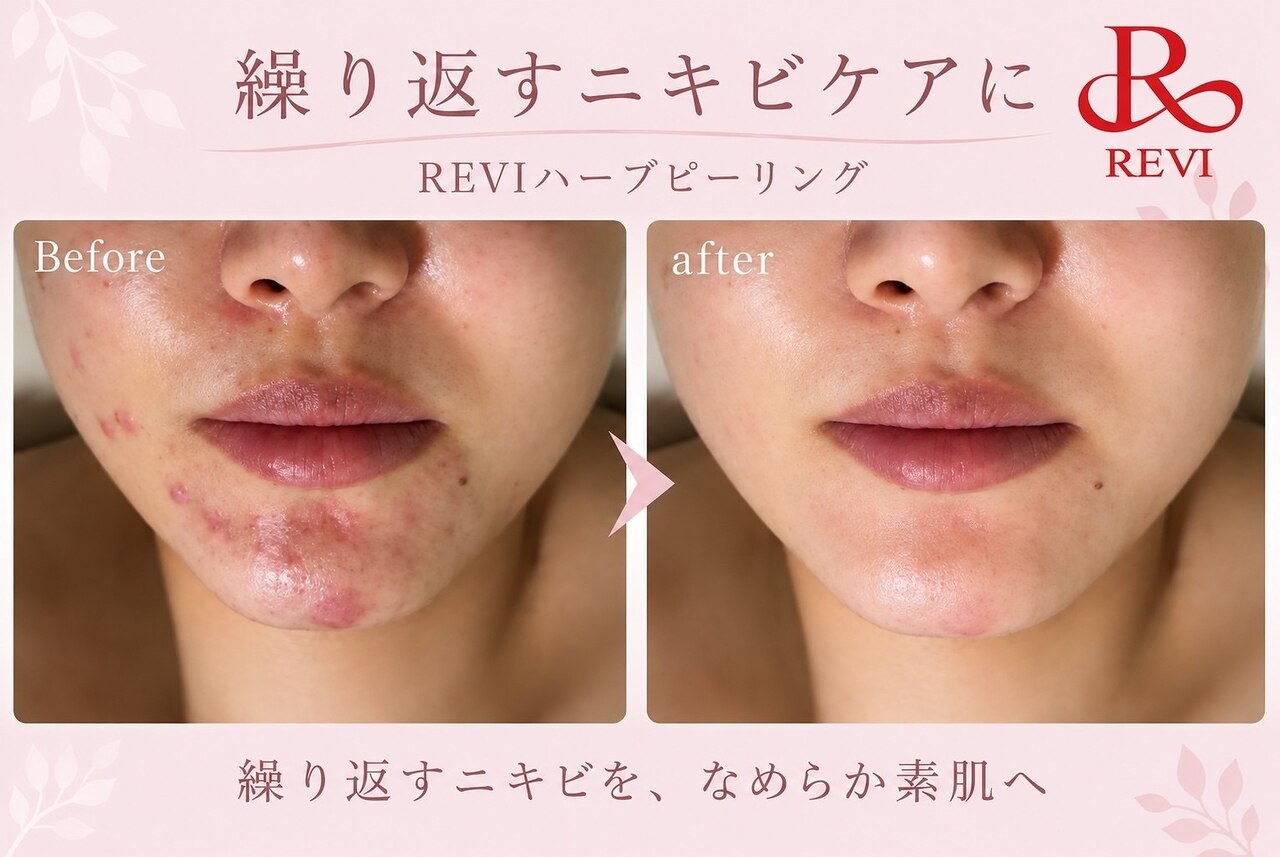 メロー(MELLOW)｜ホットペッパービューティー