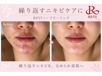 メロー(MELLOW)の写真