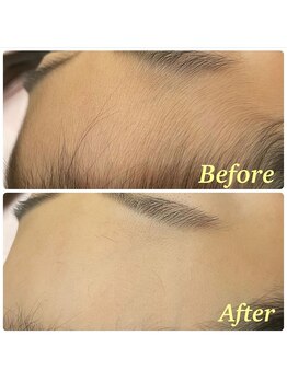 ラボーテ(La Beaute)/艶感＆肌質UP★顔の産毛脱毛