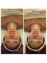 筋線美術コルギ 目黒店/自分のご褒美スッキリコース