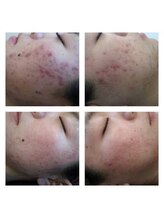 スピード美人 横浜店/BeforeAfter３