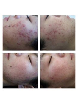 スピード美人 横浜店/BeforeAfter３