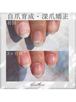 アトリエ ミュリー 代官山(atelier murir)/自爪育成・深爪矯正・巻き爪ケア