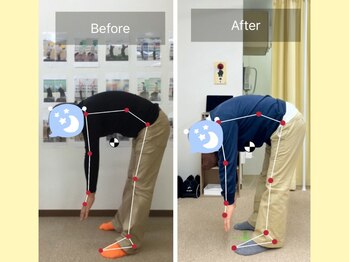 ナオル整体 春日部院(NAORU整体)/前屈ができるようになった！