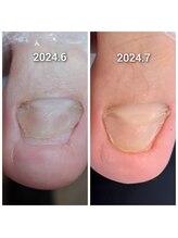 爪切り屋 足楽/諦めず～その１