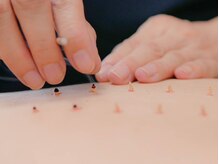 ノア鍼灸院 温灸堂(NOA鍼灸院)/