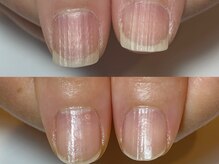 キラネイル アンド アイラッシュ by World Beauty(KIRA)/自爪育成