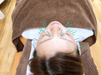 宇宿鍼灸整骨院/鍼灸【美容鍼】