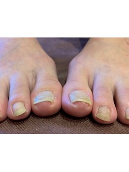 爪の悩みを解消できる（ケア含む）