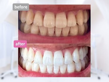 ルル 渋谷駅宮益坂店(Lulu)