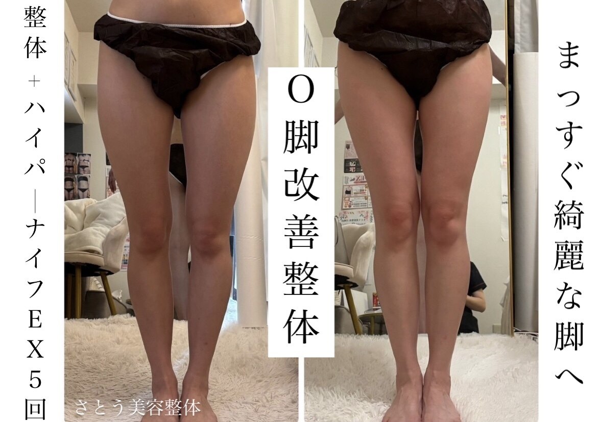 フォト｜さとう美容整体 町田店｜ホットペッパービューティー