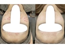 フォルチェ 三川町(Folche)/《フェイシャル》