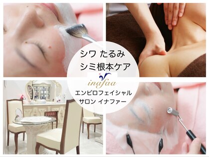 イナファーの写真