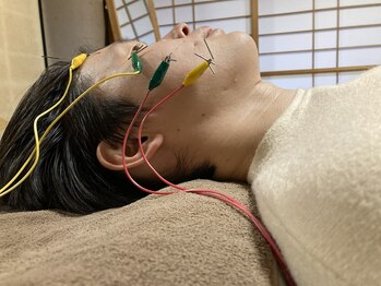 和楽美の写真/たるみ・ほうれい線に電気美容鍼リフトアップ！骨格から姿勢、お顔のゆがみ、小顔効果◎。小顔維持へ導く