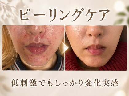 エヴァル(ewalu)の写真