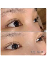 アリーマーケット(ALLEY MARKET)/