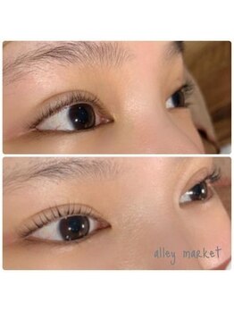 アリーマーケット(ALLEY MARKET)/