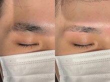 アイクイック 原宿(Ai Quick)/アイブロウワックス脱毛