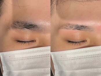 アイクイック 原宿(Ai Quick)/アイブロウワックス脱毛