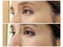 キラリ(Kirari)/目の奥の痛みが減り目元スッキリ