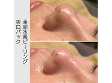 全顔水素ピーリング＋美白パックはお肌が整います