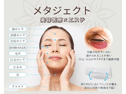 エステティック レイビス 旭川店(RAYVIS)の写真