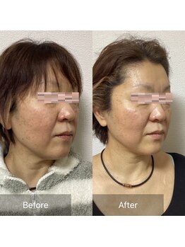 小顔整体 優/小顔で若返る！