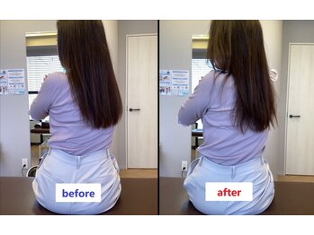ドクターズリゾート(Dr's Resort:)/背部構造調整例