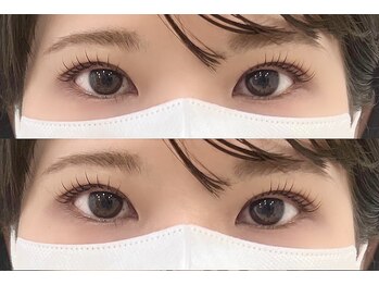 アルーマ アイ(allma.eye)/まつ毛パーマ ラッシュリフト