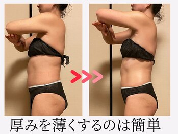 ツーアップ(2up)/上半身厚み