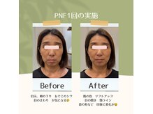 表情筋へのアプローチで、健康的な表情を取り戻す。