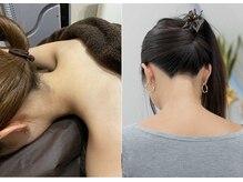 ミース 宮崎店/うなじ矯正でここまでキレイに