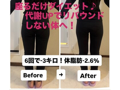 ヨサパーク ビープラス(YOSA PARK B+)の写真